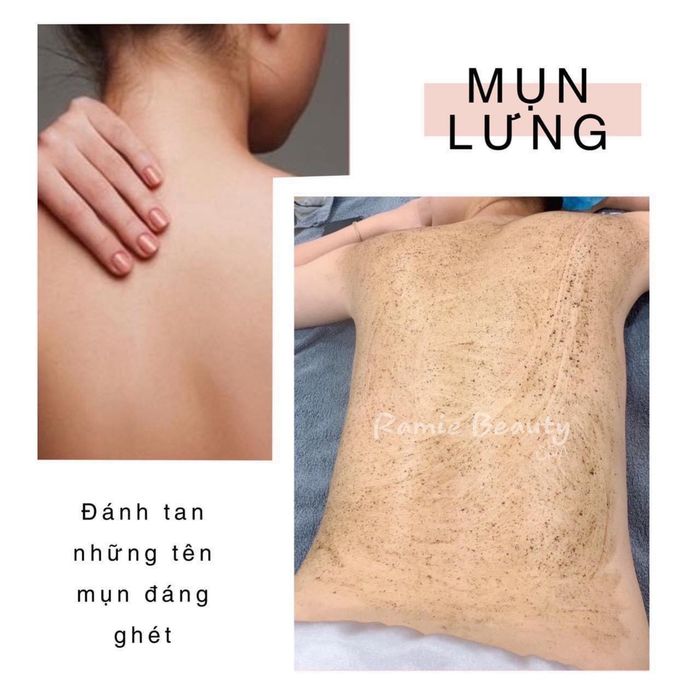 Ramie Beauty ảnh 2 - Góc nhìn chân thực về quy trình chăm sóc da bài bản, nơi mỗi bước điều trị đều mang đến sự thay đổi diệu kỳ.