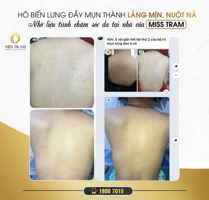 Miss Trâm Spa ảnh 2 - Góc nhìn chân thực về quy trình chăm sóc da bài bản, nơi mỗi bước điều trị đều được thực hiện bởi bàn tay vàng của chuyên gia