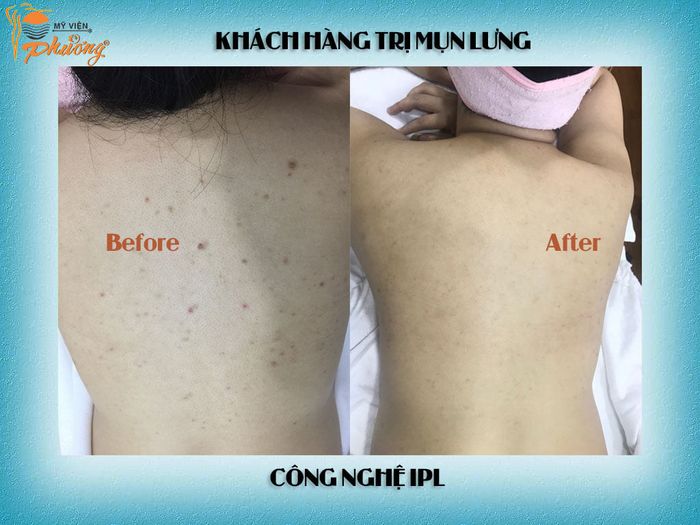 Mỹ viện Phương ảnh 2 - Không gian sang trọng với hệ thống máy móc hiện đại, nơi mỗi liệu trình trị mụn là một tác phẩm nghệ thuật chăm sóc da