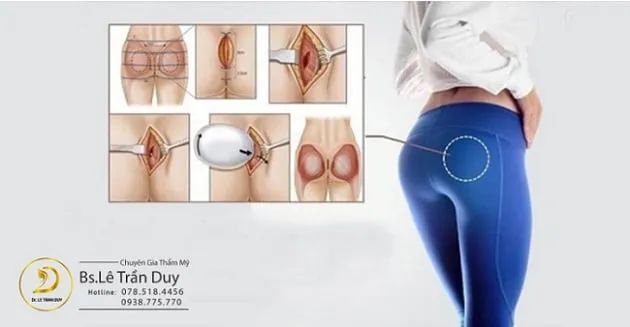Vòng 3 quyến rũ, hài hòa tự nhiên, khiến mọi ánh nhìn đều phải ngước nhìn.