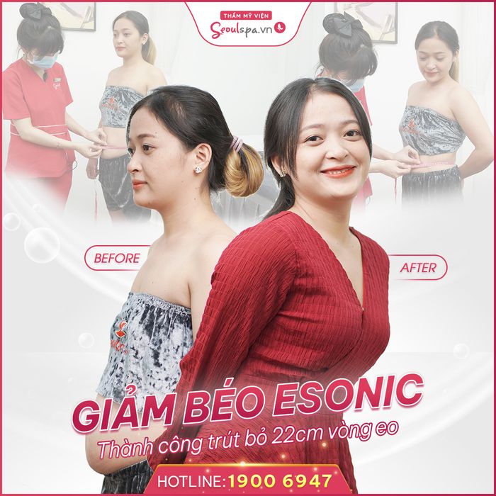Thẩm mỹ viện SeoulSpa Đà Nẵng - Hình ảnh 1