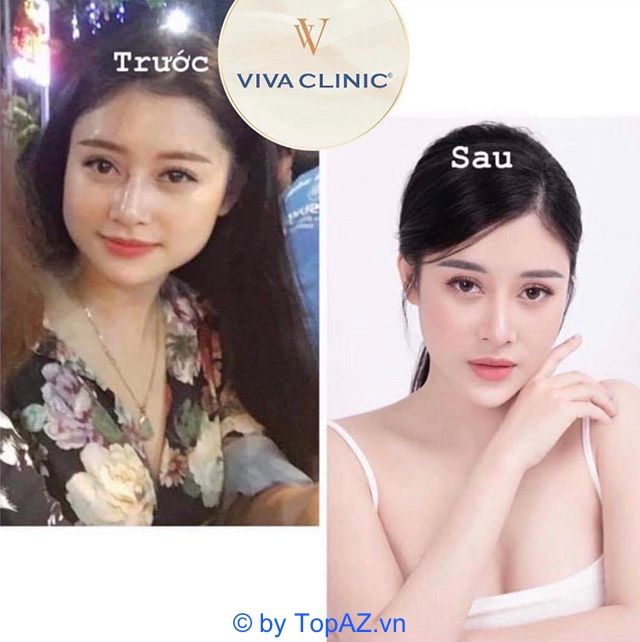 Địa chỉ vàng về trị mụn và chăm sóc sắc đẹp chuẩn y khoa tại Bến Tre