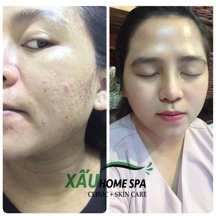 Không gian sang trọng và đẳng cấp tại Xấu Home Spa