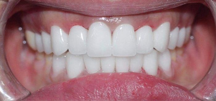 Hình ảnh thực tế về không gian hiện đại tại Nha Khoa Quốc Tế Thiện Nhân Lào Cai