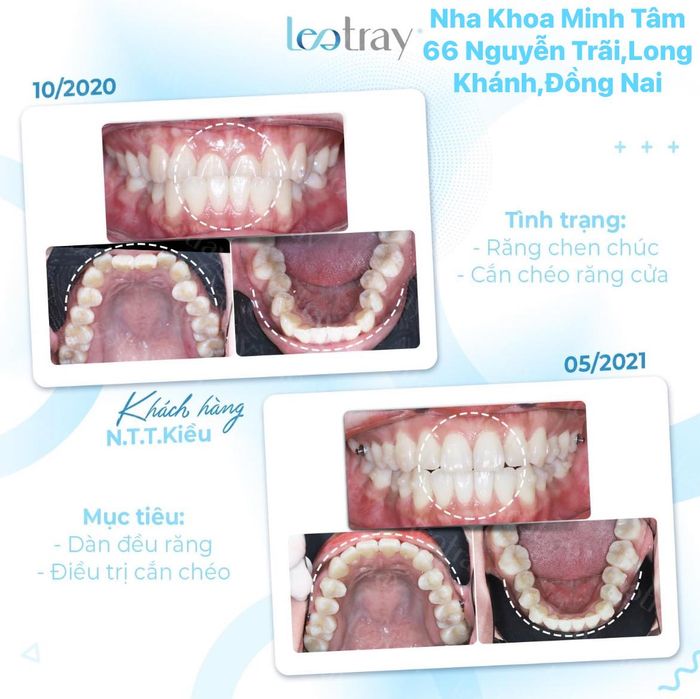 Hình ảnh thực tế về cơ sở vật chất tại Nha Khoa Minh Tâm