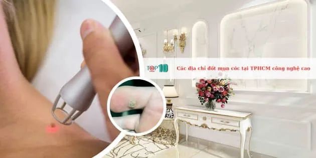 Các Trung Tâm Ứng Dụng Công Nghệ Cao Trong Điều Trị Mụn Cóc Ở TP.HCM