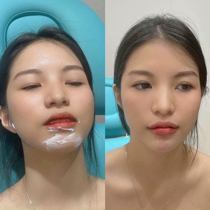 Hình ảnh LAN ANH SPA 2