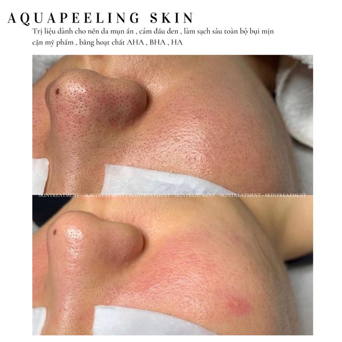 SKINTREATMENT - Spa & Beauty Natural - Hình ảnh 2
