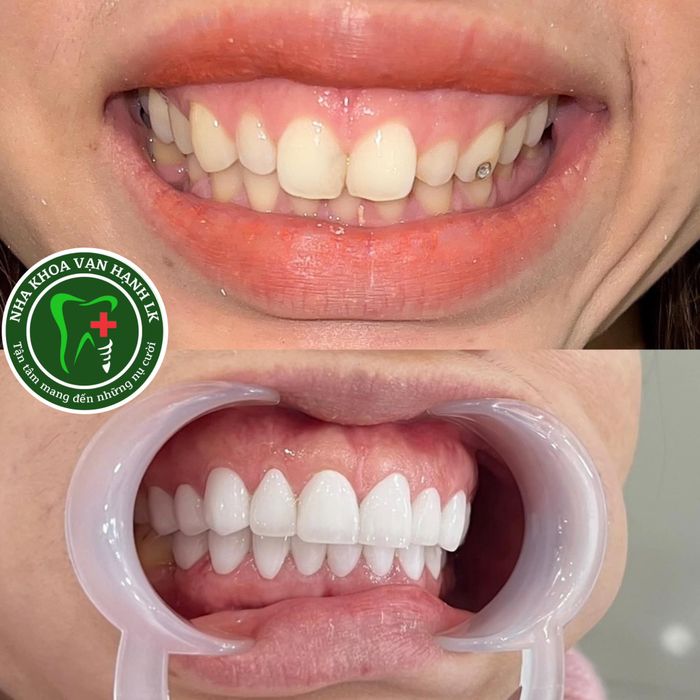 Đội ngũ bác sĩ chuyên môn cao tại Nha Khoa Vạn Hạnh Long Khánh