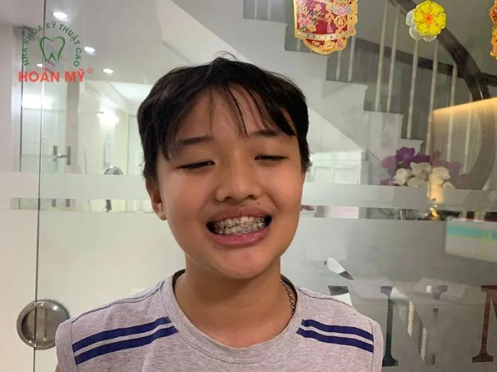 NHA KHOA HOÀN MỸ ảnh 1
