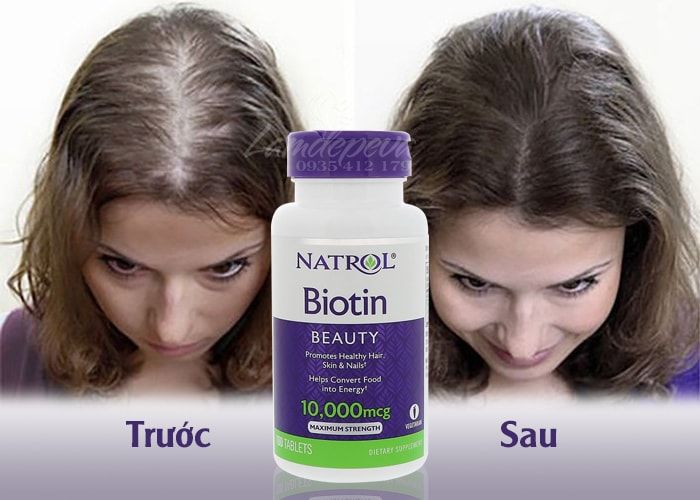 Hình ảnh minh họa số 2 - Viên uống Biotin Natro với công thức đặc biệt cho tóc bóng mượt