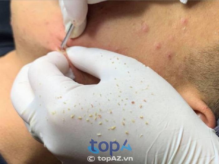 Tọa lạc tại Tây Ninh, Cẩm Lê Skincare là thương hiệu làm đẹp được yêu thích nhờ chất lượng dịch vụ vượt trội và hiệu quả chăm sóc da đáng kinh ngạc.