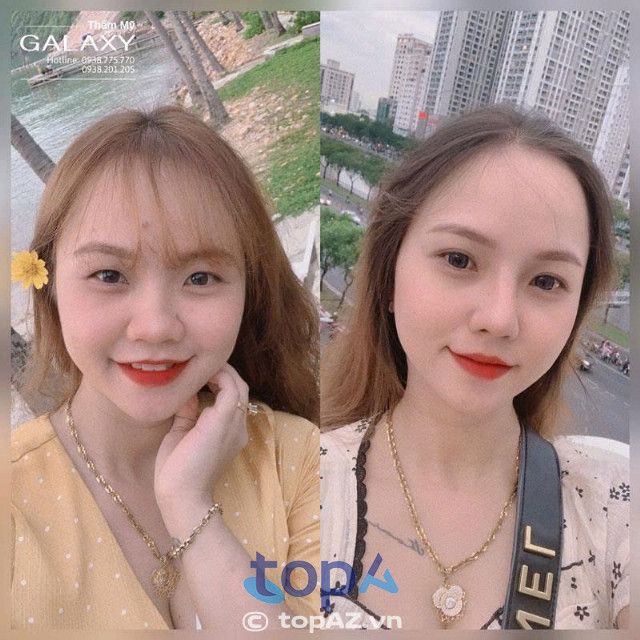 Thẩm mỹ Galaxy dưới sự điều hành của bác sĩ Lê Trần Duy, nơi mang đến vẻ đẹp hoàn hảo cho đôi mắt.