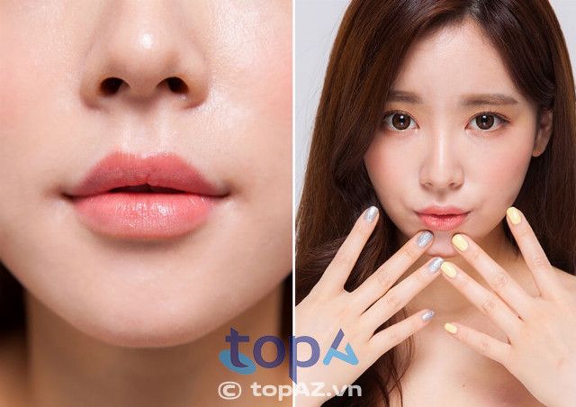Công nghệ tạo hình môi đẹp chuẩn y khoa