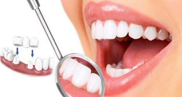 Hệ Thống Nha Khoa Quốc Tế Dr.K - Định nghĩa mới về chất lượng nha khoa cao cấp