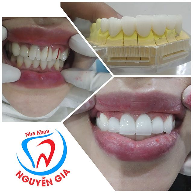 Hệ thống nha khoa chất lượng với chi phí hợp lý tại TP. Kon Tum