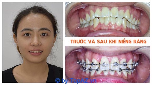 Nha khoa Đông Sài Gòn - Đẳng cấp nụ cười hoàn mỹ