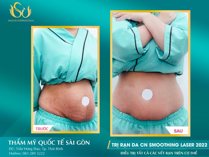 Không gian hiện đại tại Thẩm Mỹ Quốc tế Sài Gòn