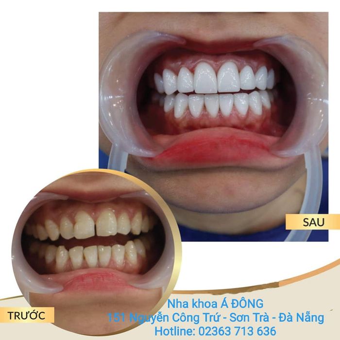 Hình ảnh phòng điều trị cao cấp tại Nha khoa Quốc tế Á Đông
