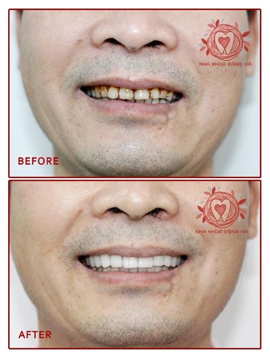Hình ảnh phòng khám hiện đại của S-Dental Nha khoa Đặng Xá