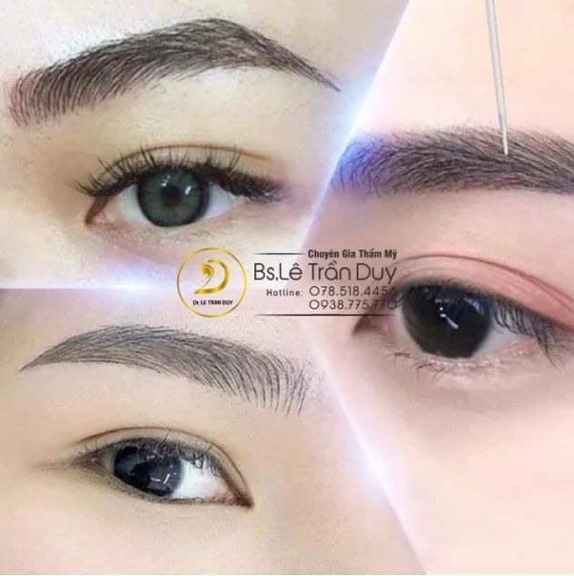 Nghệ thuật điêu khắc chân mày hoàn mỹ - Bàn tay vàng của bác sĩ thẩm mỹ tài ba