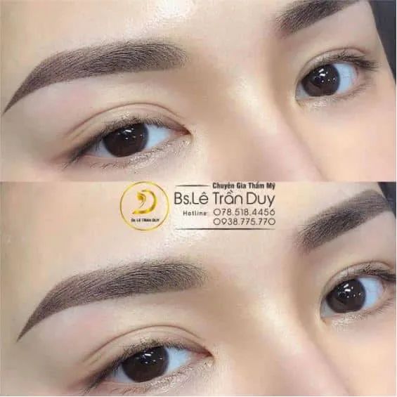 Sở hữu đôi chân mày hoàn hảo - Kiệt tác nghệ thuật từ bàn tay bác sĩ thẩm mỹ tài hoa