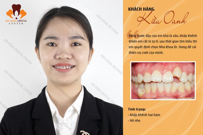 Một góc hiện đại tại Dr Hưng Dental Center – Nha khoa Trâu Quỳ