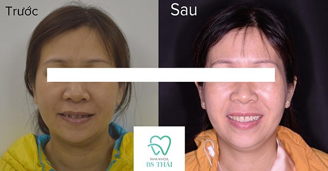 Nha Khoa Bác Sĩ Thái - Địa chỉ vàng chăm sóc răng miệng tại Bảo Lộc