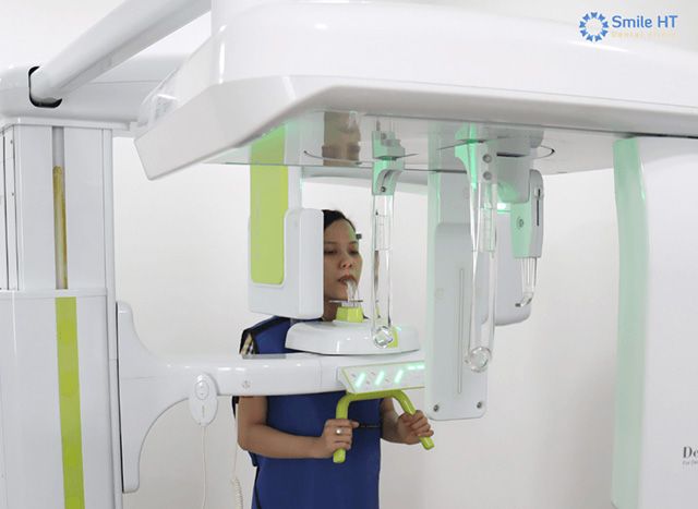 Smile HT-Bảo Lộc - Địa chỉ nha khoa thẩm mỹ uy tín, nơi mang đến những nụ cười tỏa sáng