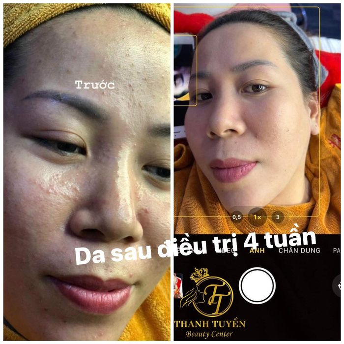 ALina Spa ảnh 2