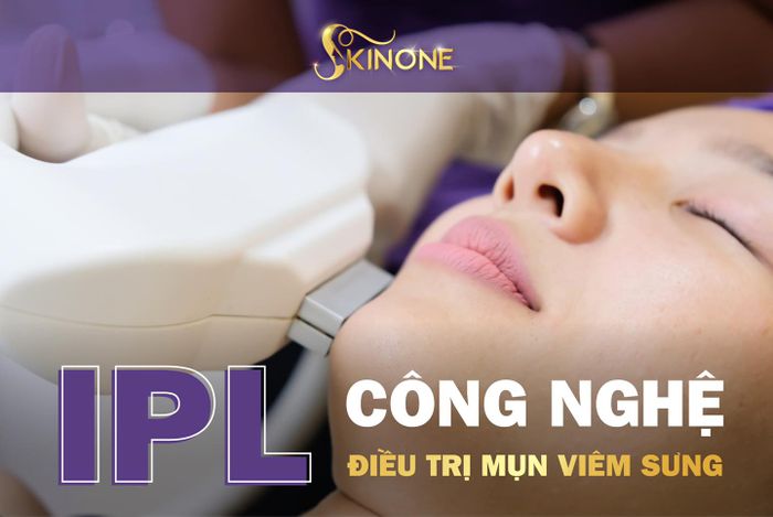 Hình ảnh quy trình điều trị chuẩn y khoa tại SKINONE