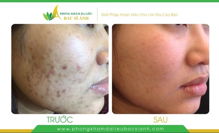 Hình ảnh quy trình điều trị chuyên nghiệp tại phòng khám TS.BS Trần Ngọc Ánh