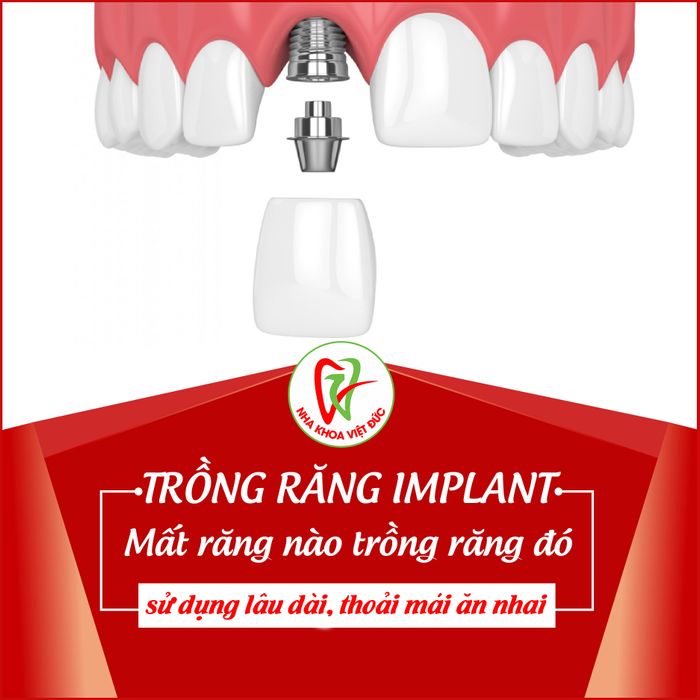 Hình ảnh Nha Khoa Việt Đức 2