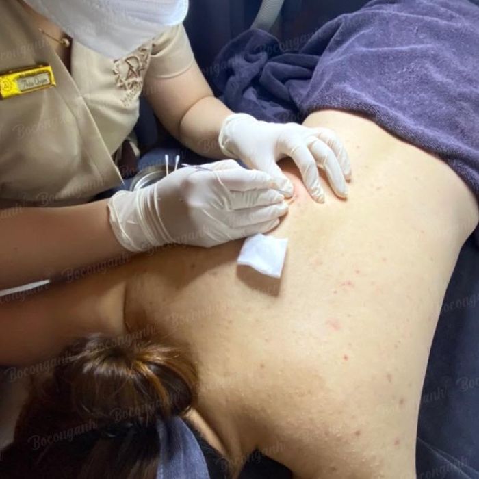 Hình ảnh quy trình điều trị chuyên nghiệp tại Boconganh Spa