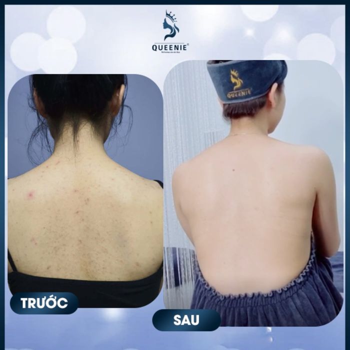 Hình ảnh quy trình trị liệu chuyên nghiệp tại Queenie Spa