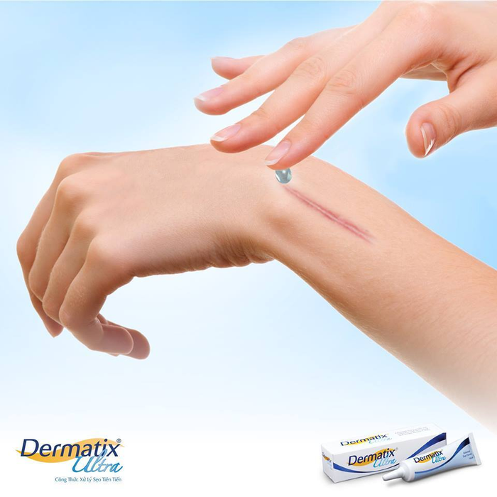Kem Dưỡng Hỗ Trợ Làm Mờ Sẹo Dermatix Ultra Advanced Scar Formula hiện đã có mặt tại Hasaki