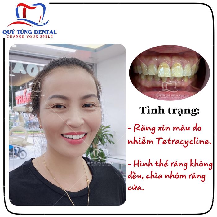Hình ảnh phòng khám tiêu chuẩn 5 sao tại Nha Khoa Quý Tùng