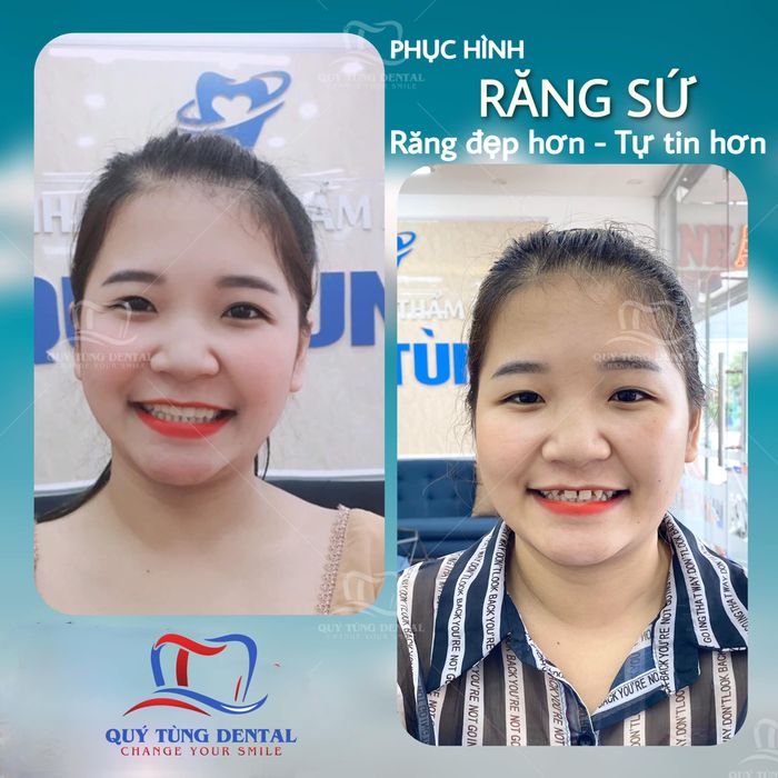 Nha Khoa Quý Tùng Thái Nguyên - Hình ảnh ấn tượng phản ánh sự chuyên nghiệp và cơ sở vật chất hiện đại.