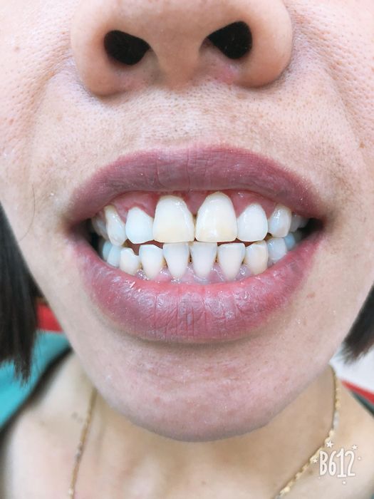 Ảnh minh họa: Nha Khoa Thẩm Mỹ Quốc Tế Thiện Nhân Lào Cai (ảnh 2)