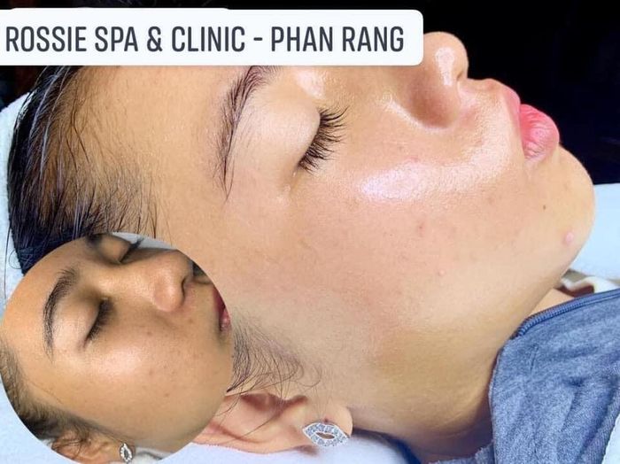 Rossie Spa & Clinic ảnh 2
