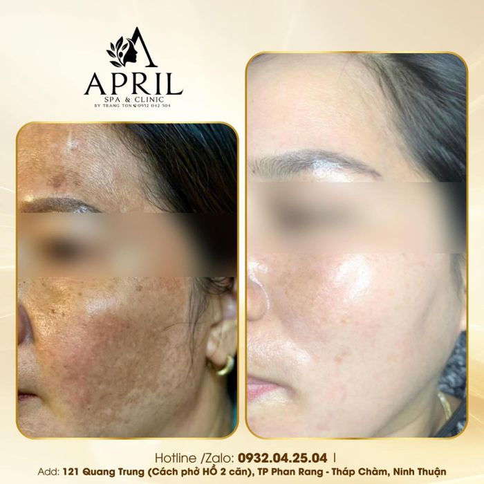 April Spa & Clinic Phan Rang ảnh 2