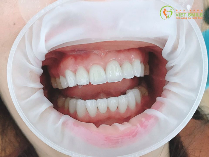 Ảnh minh họa: VIET SMILE - Viện Thiết Kế Nụ Cười 4.0 (ảnh 1)