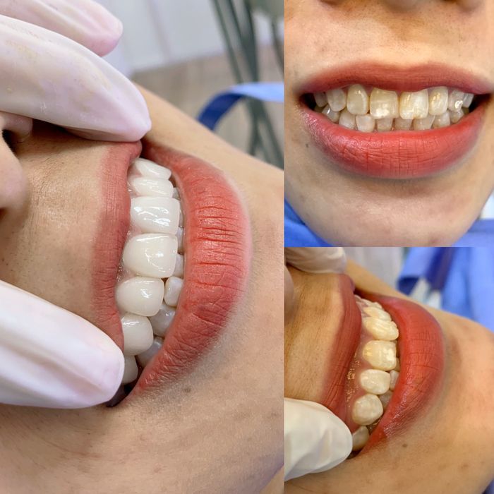 Ảnh minh họa: Nha Khoa Thẩm Mỹ Lào Cai - Ann Dental (ảnh 1)
