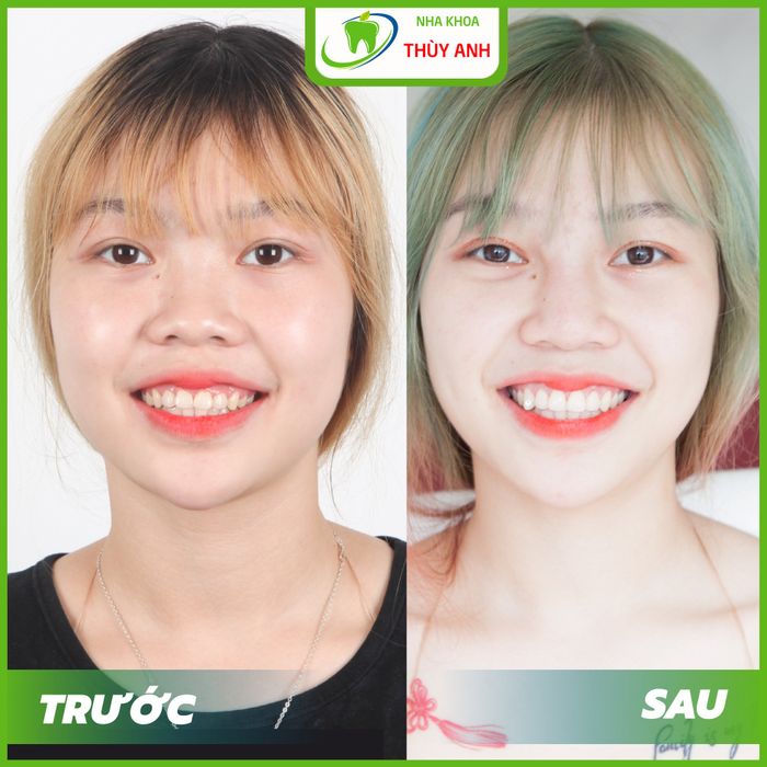 Nha Khoa Thùy Anh - Hình ảnh 1: Cơ sở vật chất hiện đại đạt chuẩn quốc tế