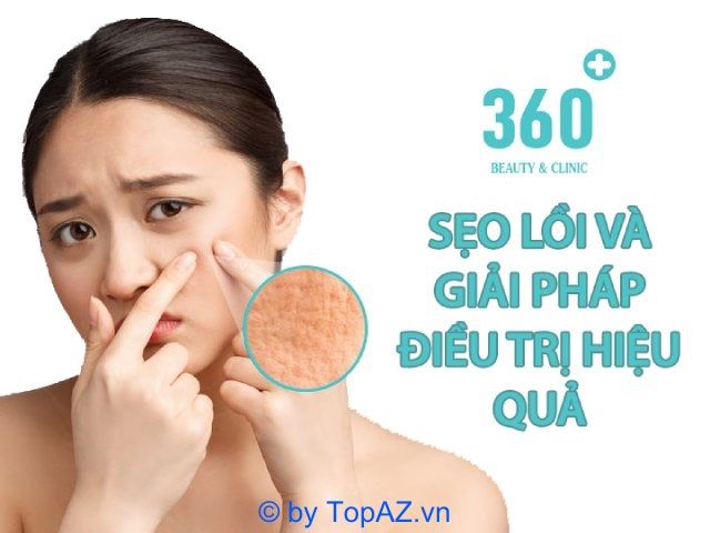 360 Beauty & Clinic xứng đáng là lựa chọn hàng đầu cho những ai đang tìm kiếm địa chỉ làm đẹp và trị mụn chuẩn y khoa tại quận Phú Nhuận.