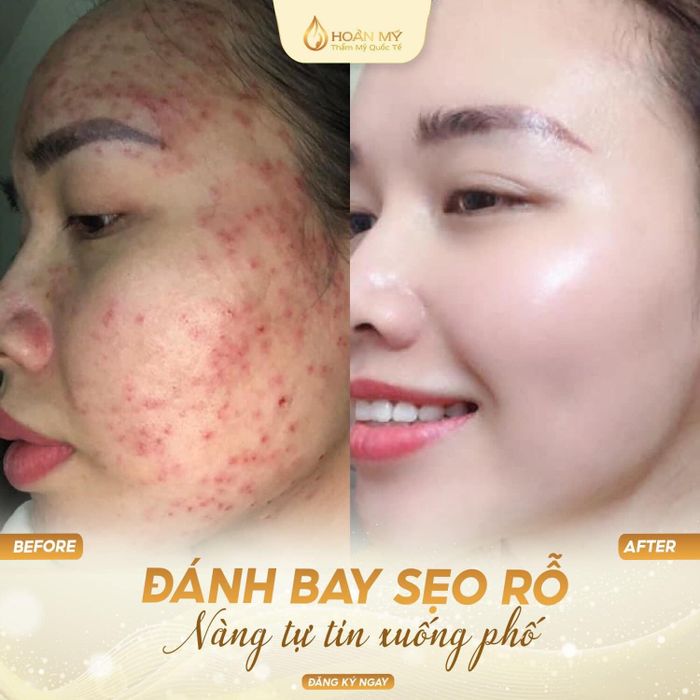 Thẩm Mỹ Quốc Tế Hoàn Mỹ ảnh 1