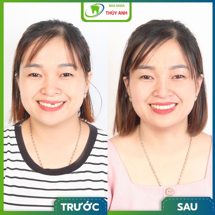 Nha Khoa Thùy Anh - Hình ảnh 2: Đội ngũ bác sĩ chuyên môn cao với trang thiết bị tối tân
