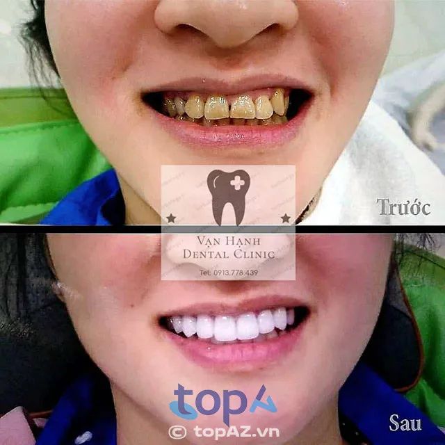 Nha Khoa Vạn Hạnh - Tiêu chuẩn vàng trong chăm sóc nha khoa