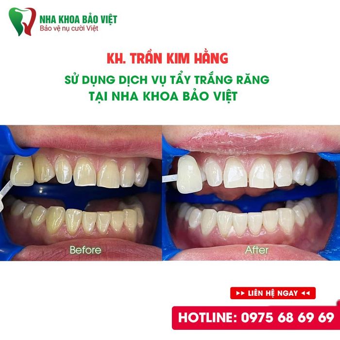 Không gian hiện đại và tiện nghi tại Nha Khoa Bảo Việt