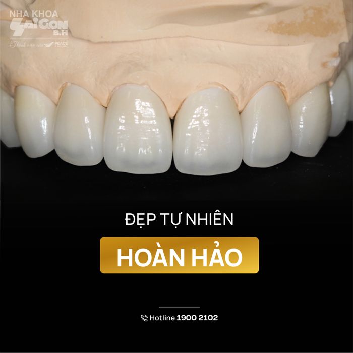 Hình ảnh đội ngũ bác sĩ chuyên môn cao tại Nha khoa Sài Gòn B.H